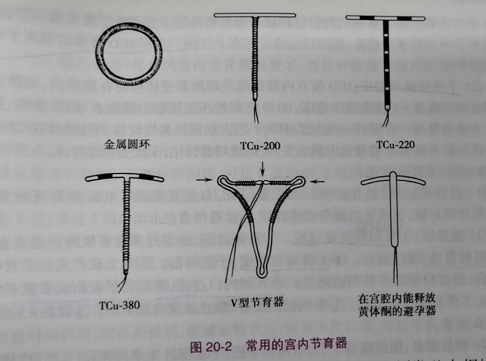 最新节育器